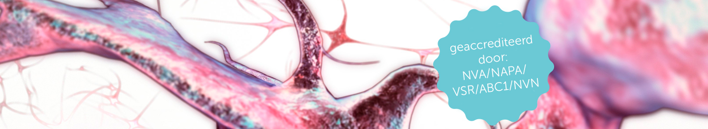 Masterclass Oncologie Neuropathische Pijn Grunenthal